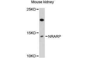 Western blot analysis of extracts of mouse kidney, using NRARP antibody (ABIN6293849) at 1:3000 dilution.