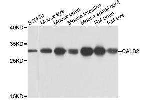 Western blot analysis of extracts of various cells, using CALB2 antibody. (Calretinin 抗体)