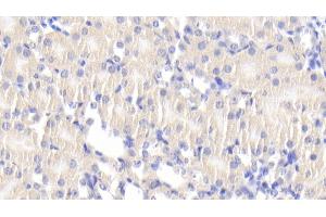 Detection of DLAT in Mouse Kidney Tissue using Polyclonal Antibody to Dihydrolipoyl Transacetylase (DLAT) (DLAT 抗体  (AA 368-626))