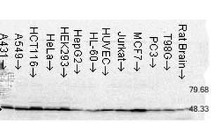 Western Blot analysis of Human Cell lysates showing detection of FKBP52 protein using Mouse Anti-FKBP52 Monoclonal Antibody, Clone Hi52C . (FKBP4 抗体  (FITC))