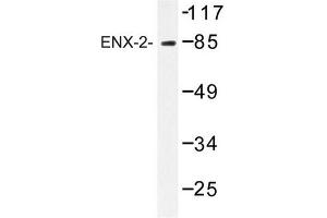 Image no. 1 for anti-Enhancer of Zeste Homolog 1 (EZH1) antibody (ABIN272247) (EZH1 抗体)