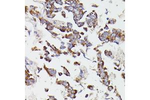 Immunohistochemistry (IHC) image for anti-Succinate-CoA Ligase, GDP-Forming, beta Subunit (SUCLG2) (AA 50-300) antibody (ABIN6148690)