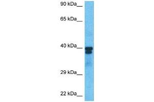 Host:  Rabbit  Target Name:  PAX6  Sample Type:  786-0 Whole Cell lysates  Antibody Dilution:  1. (PAX6 抗体  (C-Term))