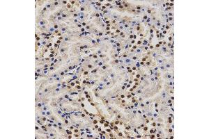 Immunohistochemistry (IHC) image for anti-Proline-, Glutamic Acid- and Leucine-Rich Protein 1 (PELP1) (AA 1021-1180) antibody (ABIN3023502)