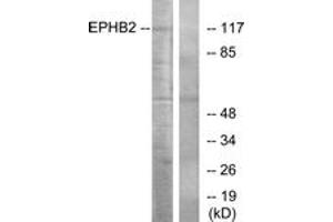 Western blot analysis of extracts from Jurkat cells, using EPHB2 Antibody. (EPH Receptor B2 抗体  (AA 991-1040))