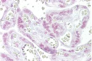 Immunohistochemistry with Placenta tissue at an antibody concentration of 10µg/ml using anti-CHEK2 antibody (ARP30290_P050) (CHEK2 抗体  (N-Term))