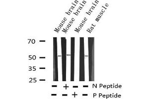 Western blot analysis of Phospho-ATF2 (Ser62 or 44) expression in various lysates (ATF2 抗体  (pSer44, pSer62))