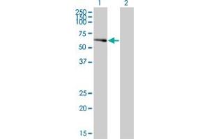 Western Blot analysis of PCTK2 expression in transfected 293T cell line by PCTK2 polyclonal antibody (A01). (CDK17 抗体  (AA 426-523))