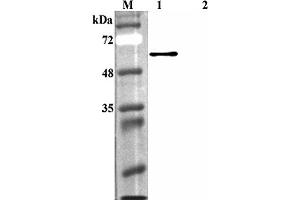 Western blot analysis using anti-FTO (human), pAb  at 1:4'000 dilution. (FTO 抗体)