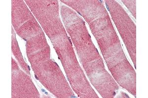 Anti-PGAM2 antibody IHC staining of human skeletal muscle. (PGAM2 抗体)