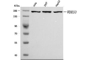 Western blot analysis of WDR33 using anti-WDR33 antibody (ABIN7602597).