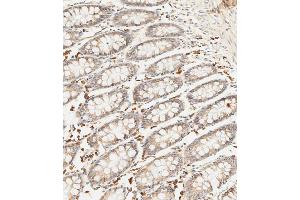 Immunohistochemical analysis of paraffin-embedded human colon tissue using (ABIN656890 and ABIN2846089) performed on the Leica® BOND RXm. (SFRP5 抗体  (AA 190-219))