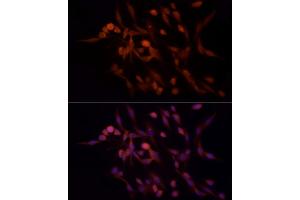 Immunofluorescence analysis of PC-12 cells using RA Rabbit mAb (ABIN7269814) at dilution of 1:100 (40x lens). (RAB8A 抗体)