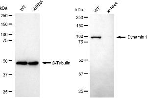 Western blotting analysis using dynamin 1 antibody (ABIN7798397). (Recombinant Dynamin 1 抗体)