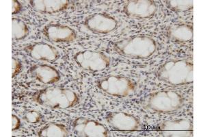 Immunoperoxidase of monoclonal antibody to CSE1L on formalin-fixed paraffin-embedded human colon. (Exportin 2 抗体  (AA 872-971))