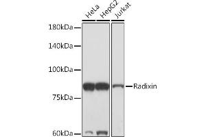 Western blot analysis of extracts of various cell lines, using Radixin Rabbit mAb (ABIN7269833) at 1:1000 dilution. (Radixin 抗体)