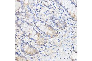 Immunohistochemistry of paraffin-embedded Human colon using WBSCR27 Rabbit pAb (ABIN7271366) at dilution of 1:50 (40x lens). (WBSCR27 抗体  (AA 1-245))