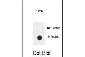 Dot Blot (DB) image for anti-Phosphinothricin N-Acetyltransferase (BAR2) (pSer261) antibody (ABIN3001865) (BAR2 抗体  (pSer261))
