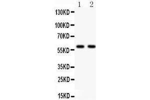 Anti- KAT13A antibody, Western blotting All lanes: Anti KAT13A  at 0. (NCOA1 抗体  (AA 614-826))