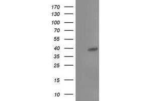 Western Blotting (WB) image for anti-TBC1 Domain Family, Member 21 (TBC1D21) antibody (ABIN1501313) (TBC1D21 抗体)