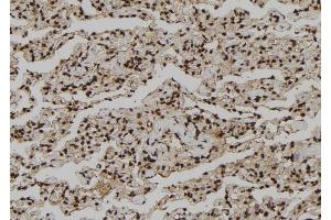 ABIN6260913 and ABIN6273210 at 1/100 staining Human lung tissue by IHC-P. (CNOT10 抗体  (Internal Region))