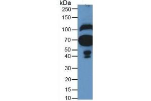 Western Blotting (WB) image for Fibulin 1 (FBLN1) ELISA Kit (ABIN6720586)