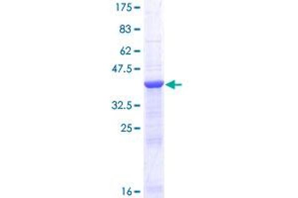 GALNT3 Protein (AA 1-141) (GST tag)