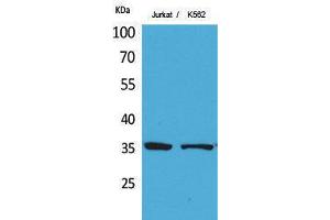 Western Blotting (WB) image for anti-Apurinic/Apyrimidinic Endonuclease 1 (APEX1) (Ser1423) antibody (ABIN3187837) (APEX1 抗体  (Ser1423))