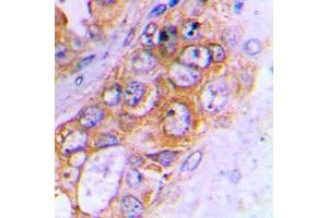 Immunohistochemistry (IHC) image for anti-ATP-Binding Cassette, Sub-Family B (MDR/TAP), Member 10 (ABCB10) (Center) antibody (ABIN7297968)