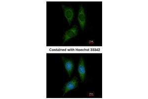 ICC/IF Image Immunofluorescence analysis of methanol-fixed HeLa, using STK25, antibody at 1:200 dilution. (STK25 抗体)