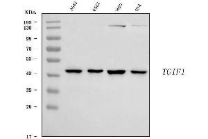 Western blot analysis of TGIF/TGIF1 using anti-TGIF/TGIF1 antibody (ABIN7600959).