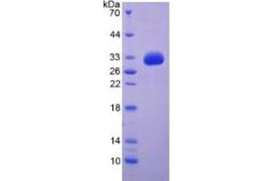 SDS-PAGE of Protein Standard from the Kit  (Highly purified E. (EGF ELISA 试剂盒)