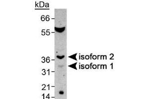Western blot analysis of SPDYA in mouse testis with SPDYA polyclonal antibody . (SPDYA 抗体  (AA 200-286))