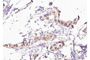 Immunohistochemistry (IHC) image for anti-Golgi-Associated, gamma Adaptin Ear Containing, ARF Binding Protein 2 (GGA2) (C-Term) antibody (ABIN6261946)