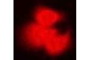 Immunofluorescent analysis of PP2C-alpha staining in Hela cells. (PPM1A 抗体)