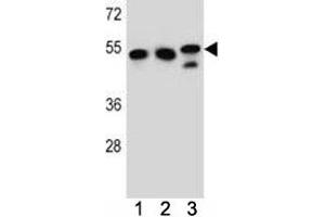 TUBB6 antibody western blot analysis in K562, HeLa, MDA-MB231 lysate. (TUBb6 抗体  (AA 139-166))