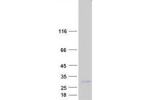 Validation with Western Blot (COPS8 Protein (Transcript Variant 2) (Myc-DYKDDDDK Tag))