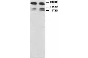 Image no. 1 for anti-Glutamate Receptor, Ionotropic, N-Methyl D-Aspartate 2B (GRIN2B) (N-Term) antibody (ABIN1494122)