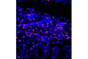 Immunofluorescence of paraffin embedded rat kidney using TCF7 (ABIN7075952) at dilution of 1:600 (400x lens) (TCF7 抗体)