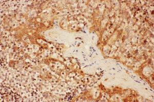 Anti- IL2RA antibody, IHC(P) IHC(P): Human Tonsil Tissue (CD25 抗体  (N-Term))