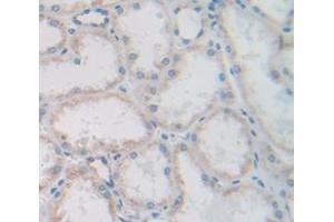 IHC-P analysis of Human Tissue, with DAB staining. (FGF13 抗体  (AA 108-227))