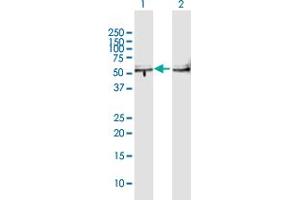 Western Blot analysis of TBL2 expression in transfected 293T cell line by TBL2 MaxPab polyclonal antibody. (TBL2 抗体  (AA 1-447))