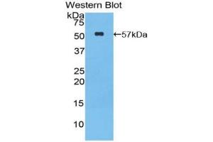 Western blot analysis of the recombinant protein. (GZMM 抗体  (AA 31-257))