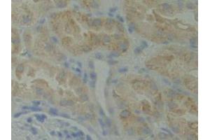 IHC-P analysis of Human Kidney Tissue, with DAB staining. (BMX 抗体  (AA 287-523))