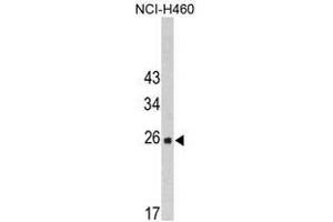 Image no. 1 for anti-FK506 Binding Protein 14, 22 KDa (FKBP14) (N-Term) antibody (ABIN453010) (FKBP14 抗体  (N-Term))
