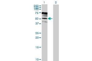 Lane 1: PSG1 transfected lysate ( 46. (PSG1 293T Cell Transient Overexpression Lysate(Denatured))