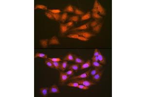 Immunofluorescence (IF) image for anti-Proteasome (Prosome, Macropain) 26S Subunit, Non-ATPase, 14 (PSMD14) antibody (ABIN7269588)