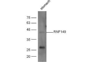 Mouse stomach lysates probed with Anti-RNF149 Polyclonal Antibody  at 1:5000 90min in 37˚C (RNF149 抗体)