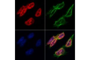 ABIN6260331 and ABIN6268800 staining Hela by IF/ICC.