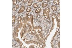 Immunohistochemical staining of human duodenum with NEO1 polyclonal antibody  shows moderate nuclear and cytoplasmic positivity in glandular cells at 1:10-1:20 dilution. (NEO1 抗体)